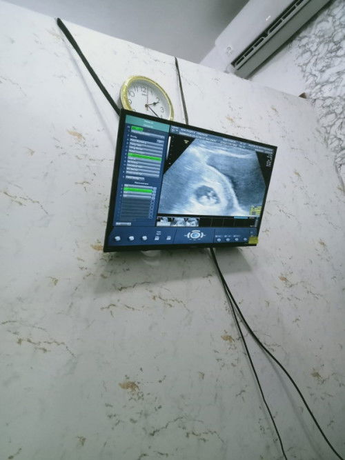 Masya Allah tabarakallah