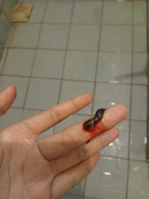 Assalamualaikum Bun
Keluar flek diusia 7week