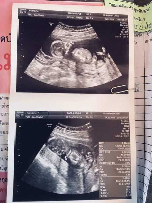 ทีมเดือนกรกฎาคม69 น้องน้ำหนักเท่าไหร่กันบ้างแล้วคะ มาอวดกันค่ะ🌷📌