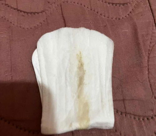 Iight brown discharge