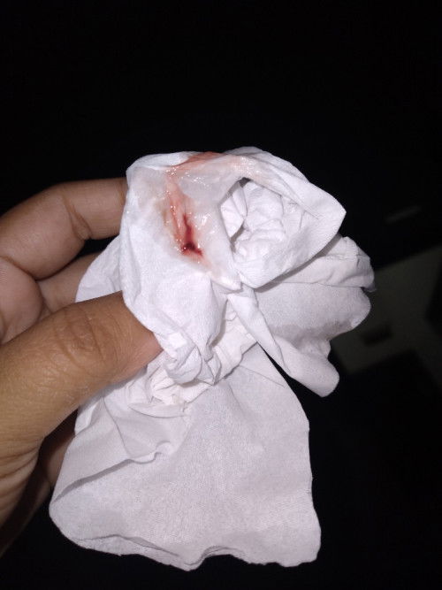 Bunda..aku hamil 6mibggu ini termasuk flek normal atau gmana yaa..btw lagi hamil pertama ..tkut bng