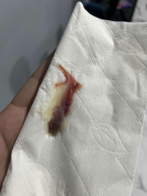 มีมูกเลือดออก