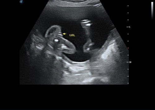 1st time scan gender
