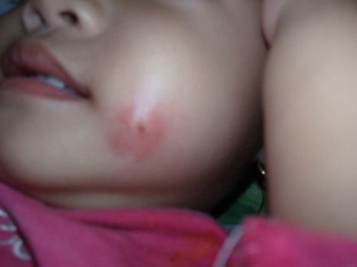 Hi mga mommies ano po kaya ito?