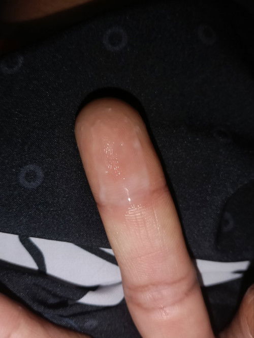 37+4 แบบนี้ใกล้คลอดยังค่ะ