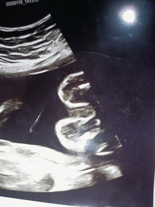 Sapa ad tahu dlm gambar ni boy ke girl??