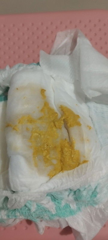 small poops looking like this po,5-6 times since this morning,3 months old baby po formula fed
ok pb