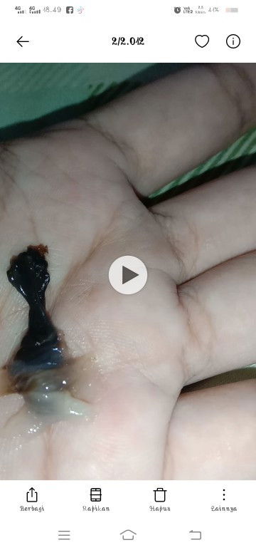 Keluar Gumpalan hitam,setalah hb