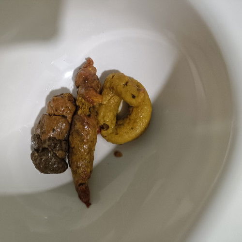 น้องอายุ7เดืนกว่าน้องถ่ายปนเลือดมา1วัน