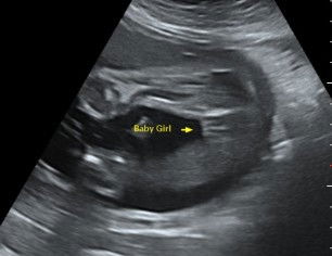 Betul ke baby girls?