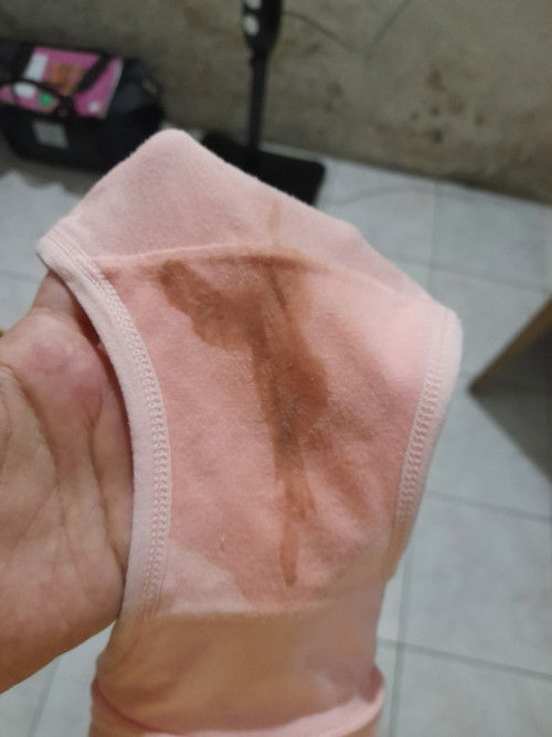 Keluar flek di weeks 38