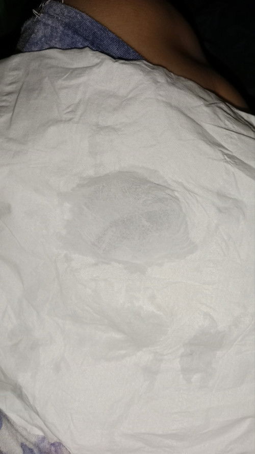 Keputihan atau air ketuban