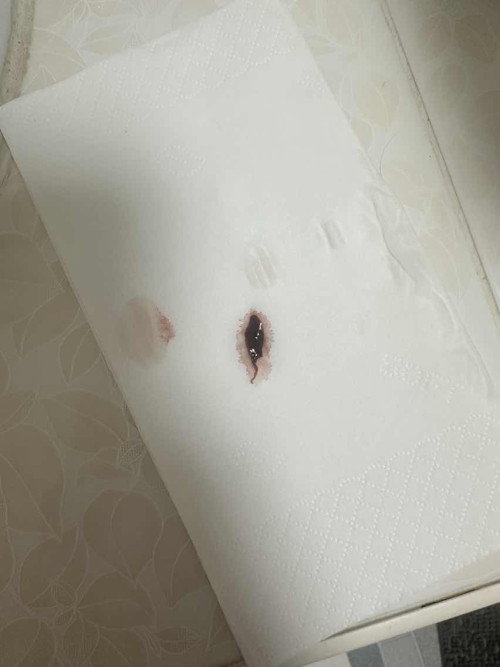 แบบนี้คือน้องยังอยู่มั้ยคะ