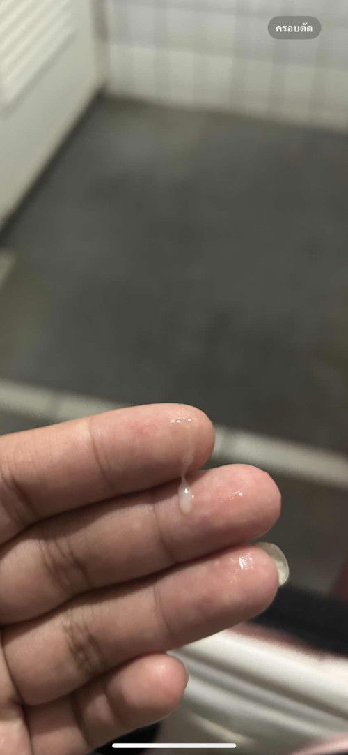 มูกใสหรือตกขาว