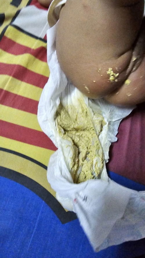 สีอึการถ่าย