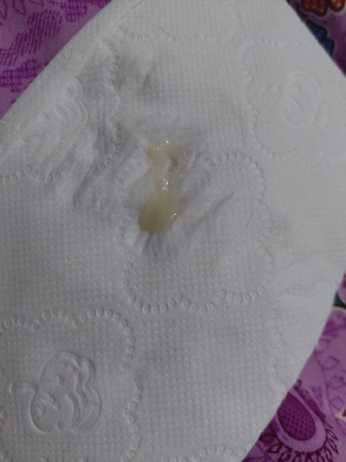 อันนี้ตกขาวรึมูกคะ