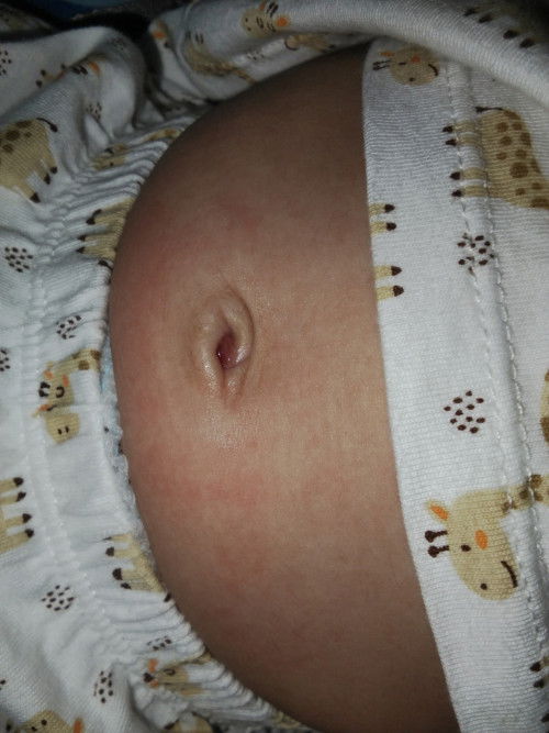 Normal atau xnormal.