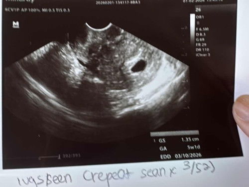 1st Scan

Normal ke nmpk sac shj?