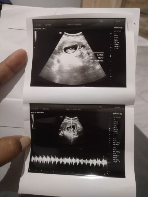 10 minggu baru terlihat seperti ini normal kan ya bun?