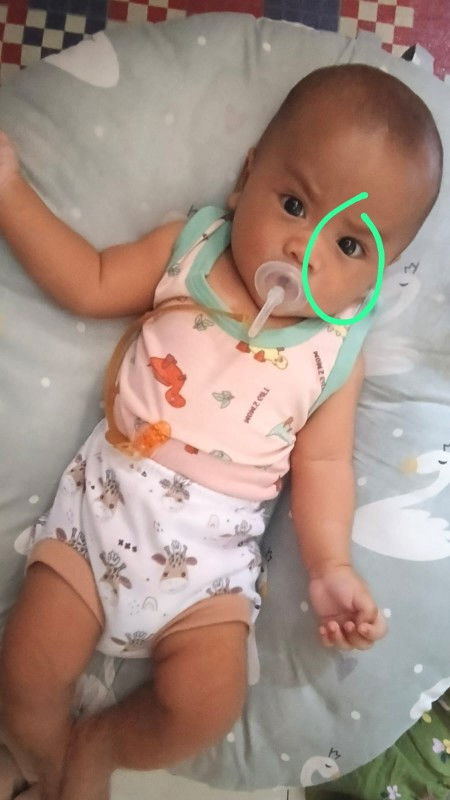 Normal kah mata anak begini