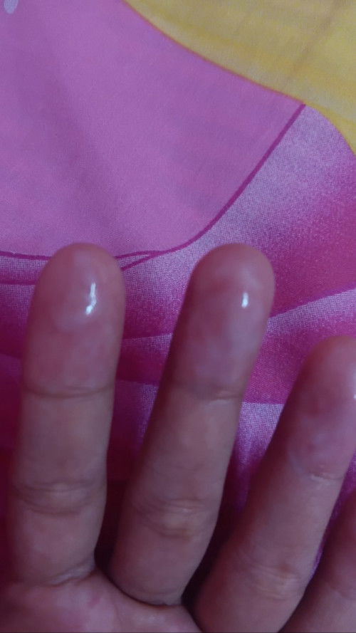 ถามแม่ๆคะต้องไปโรงพยาบาลไหม