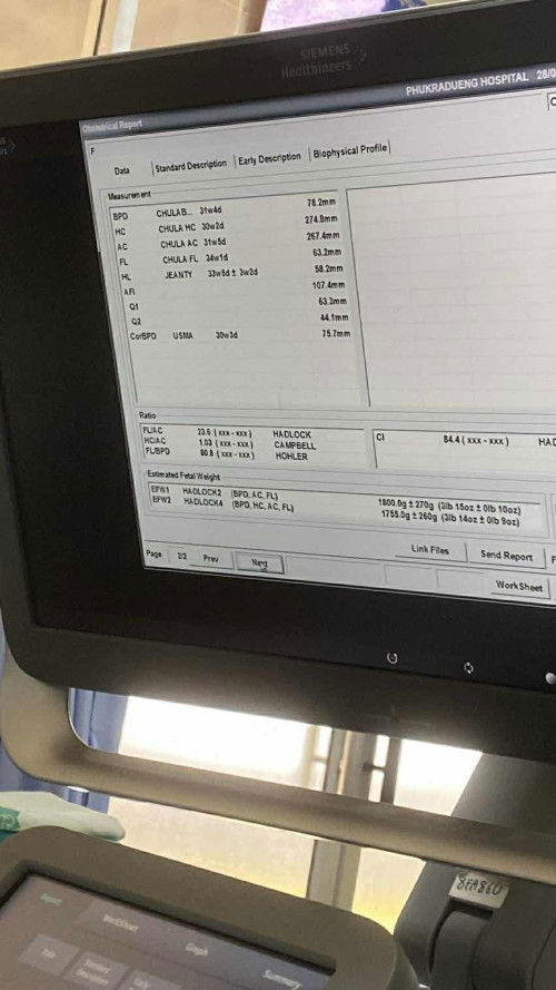 ขอถามค่ะแม่ๆ