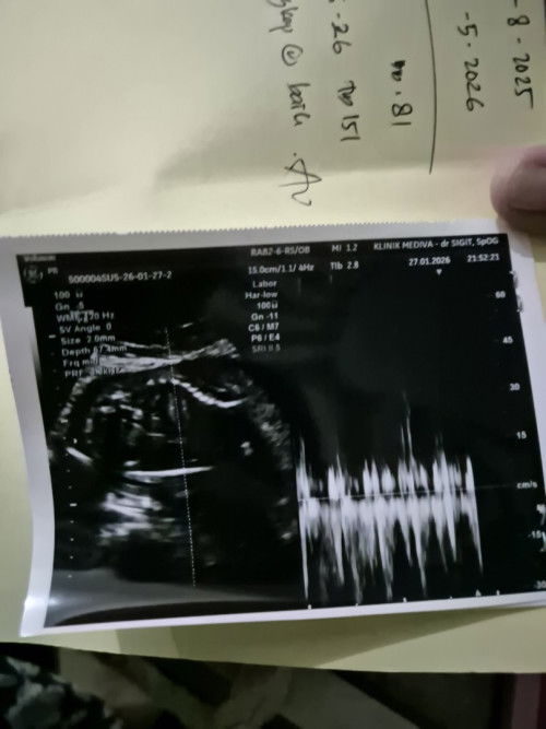 Kehamilan 26weeks