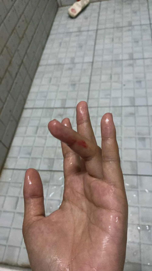 แบบนี้คืออะไรหรอคะ
32w3d