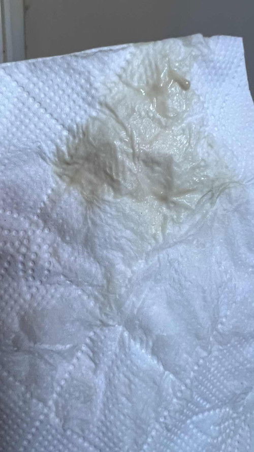 ตั้งครรภ์6วีค มีตกขาวแบบนี้ อันตรายไหมคะ