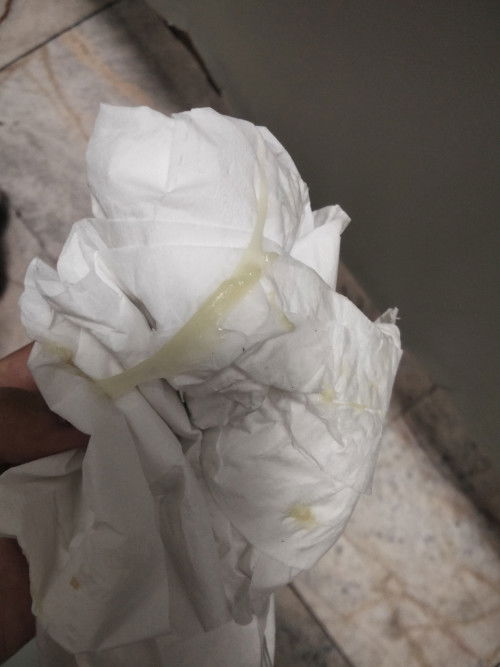 อัตรายมั้ยคะ