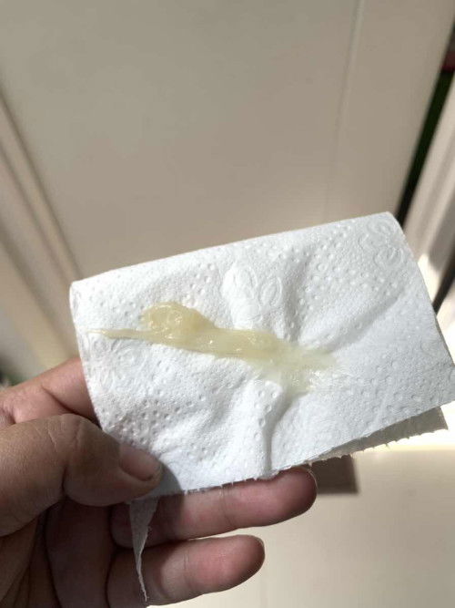 อันนี้มูกหรือตกขาวคะแม่ๆ พอดีเข้าห้องน้ำแล้วเพิ่งเคยเป็น