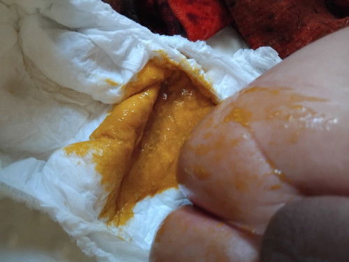 น้อง4เดือนถ่ายแบบนี้