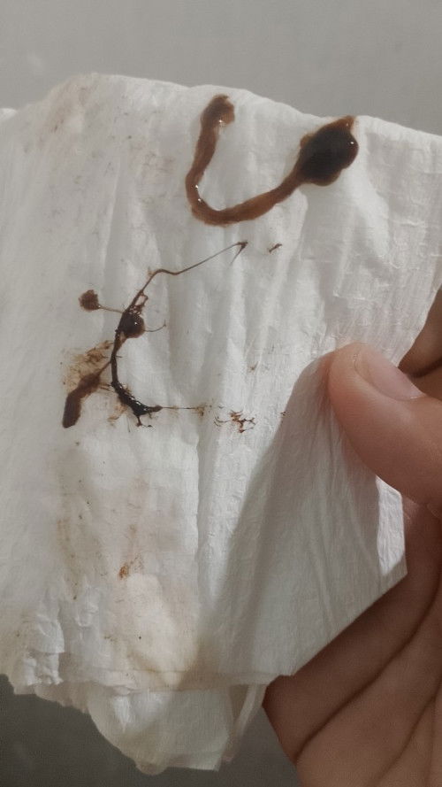 After ko ma IE kaninang tanghali may lumabas na saken na mucus plug