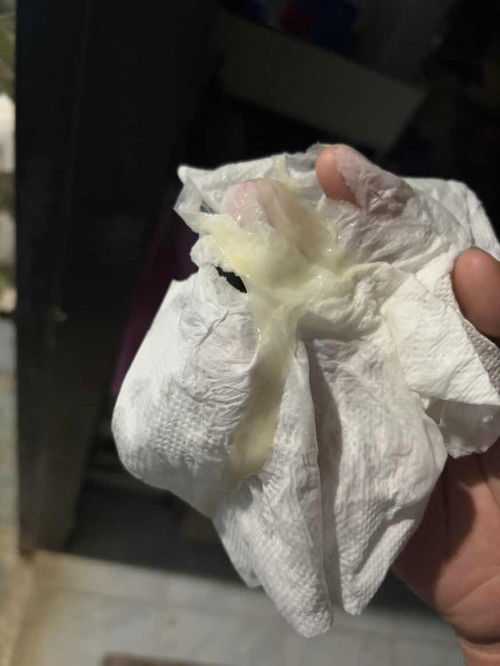 ขอสอบถามผู้รู้หน่อยค่ะ 39+5