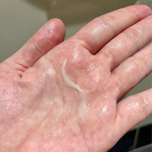 Mucus plug atau keputihan