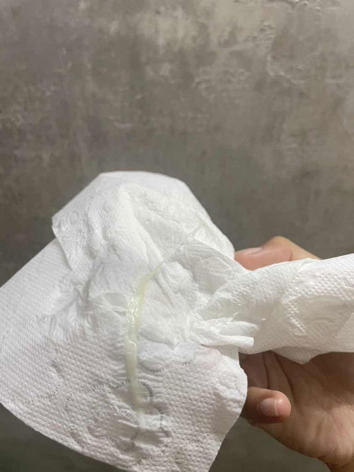 มูกหรือตกขาวคะแม่ๆ