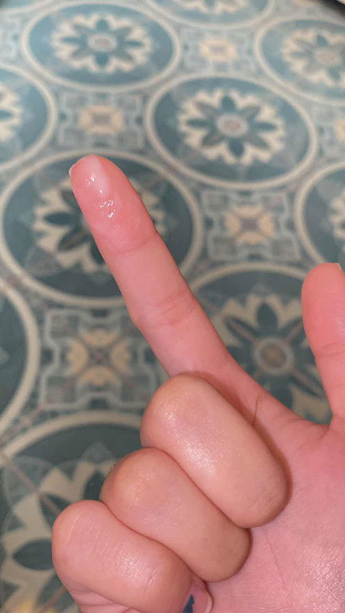 สอบถามหน่อยค่ะแม่ๆ อันนี้ตกขาวหรือป่าวคะ พอดีท้องแรกค่ะ🥹