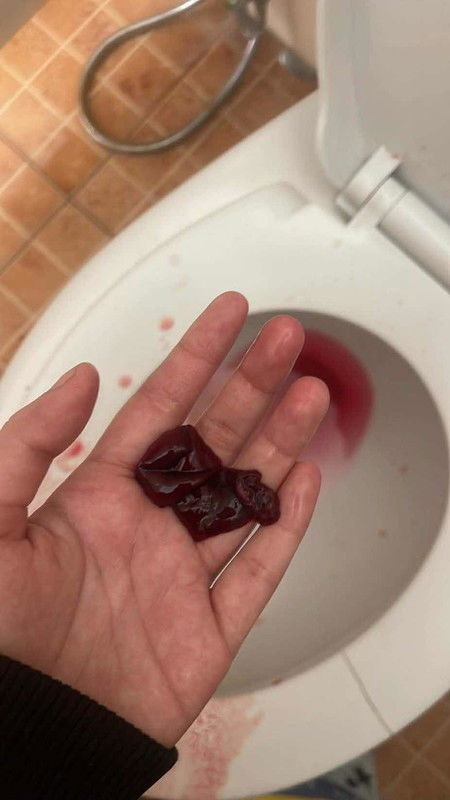 แบบนี้แท้งไหมคะ