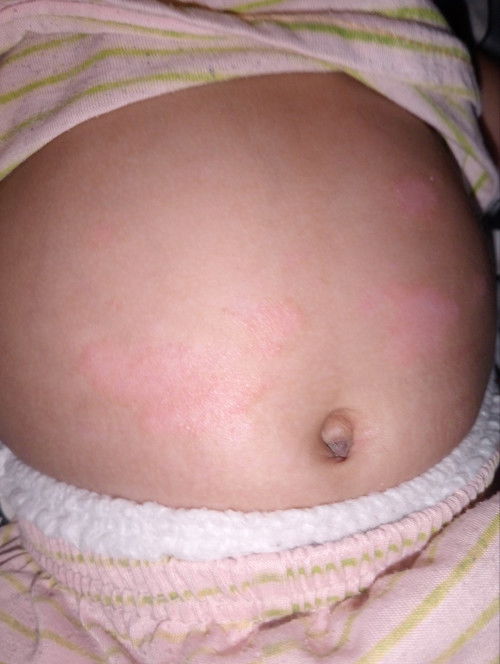 Kulit bayi