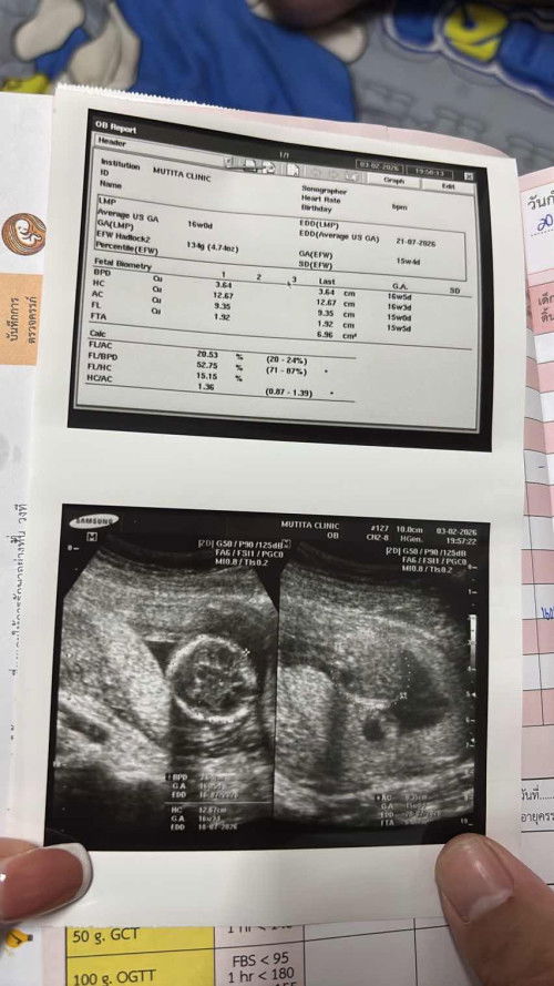 เเม่ช่วยดูหน่อยค่ะ