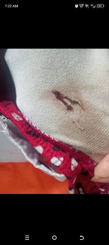 18 weeks preggy may nalabas po saken na discharge na color brown like Ng ganto normal po kaya ?