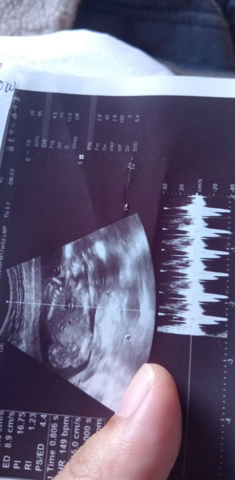 Sa tingin nyo po ano gender ni baby?