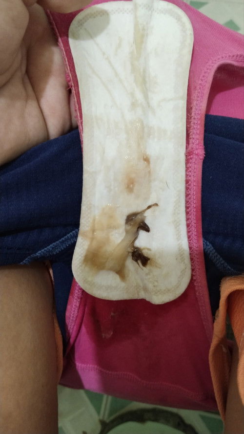 Mucus plug with blood