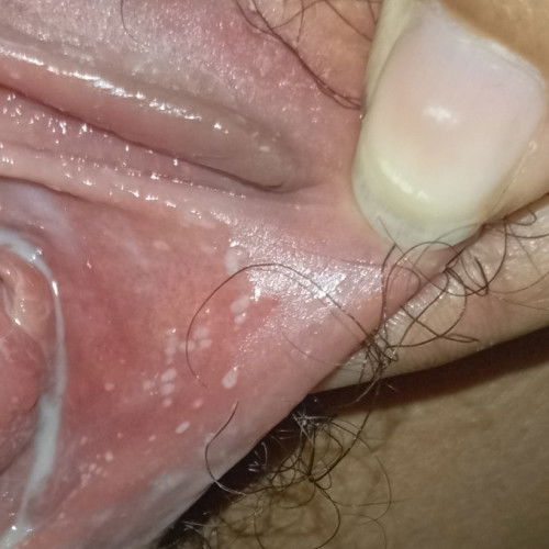 ช่องคลอด มีจุดเล็กๆ