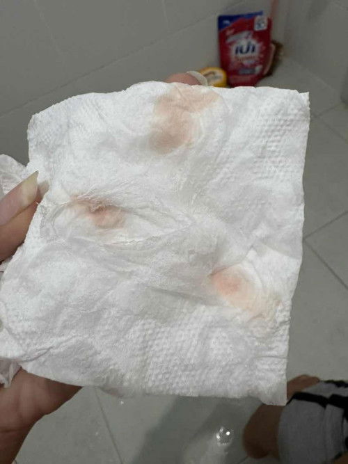 แม่ๆคนไหนเลือดออกบ้างค่ะ