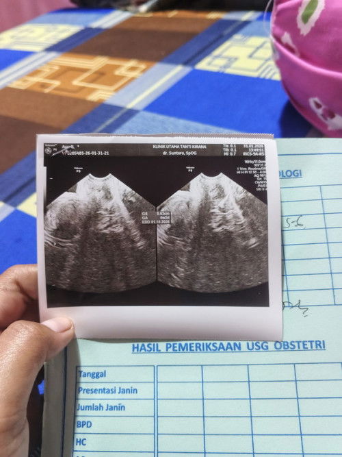 Normal gak ya Bun bantu jawab bunda🙏🏻