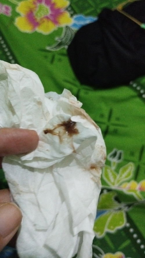 Flek saat hamil 26 minggu