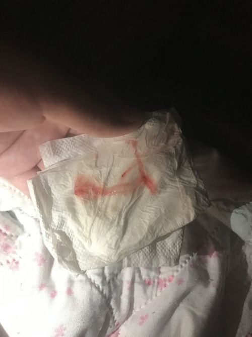 ต้องไปหาหมอเลยมั้ยคะ38+3wessk