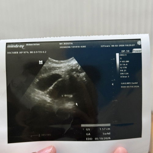 5w4d belum keliatan kantung janin