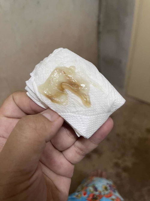 โดนคุณหมอกระตุ้นคลอด